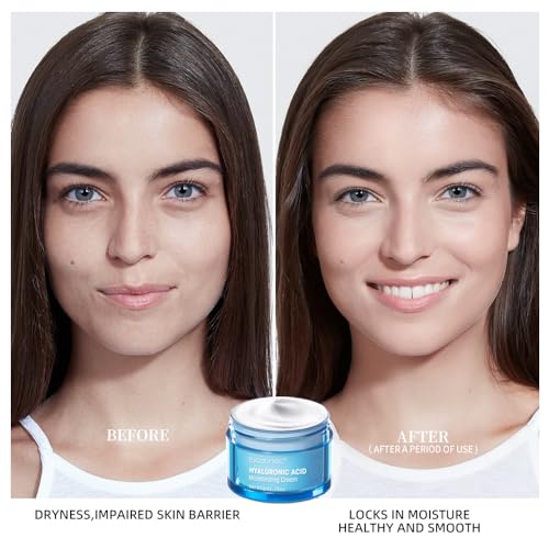 Hyaluronic Acid Moisturizing Water Gel, 1.76 Oz J215